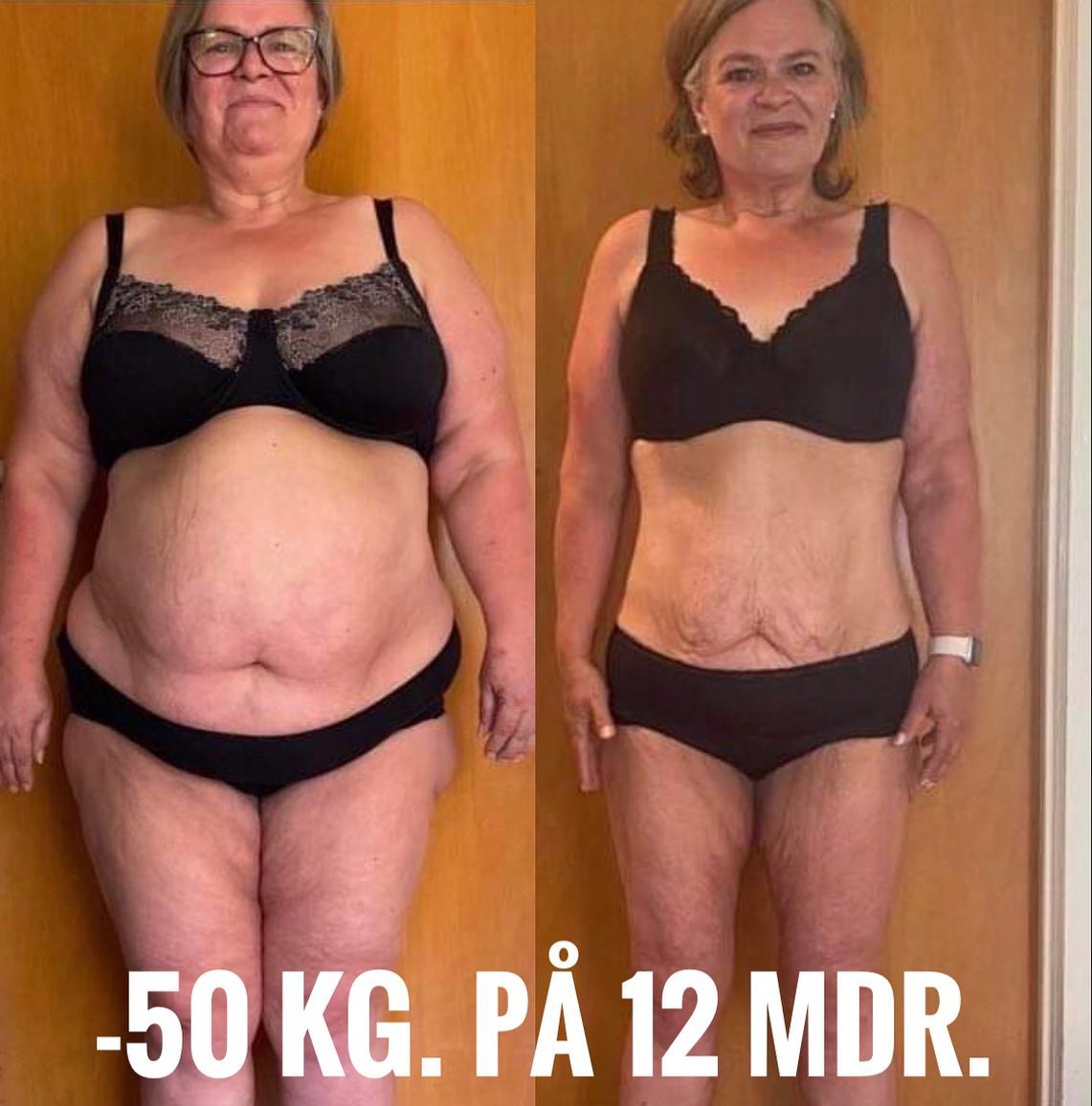 Tina-Jensen-50-kilo-på-12-mdr.-endelig-slit-med-diabetes-2-og-nu-med-normalt-blodtryk.jpg